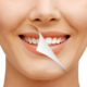 teeth-whitening-01